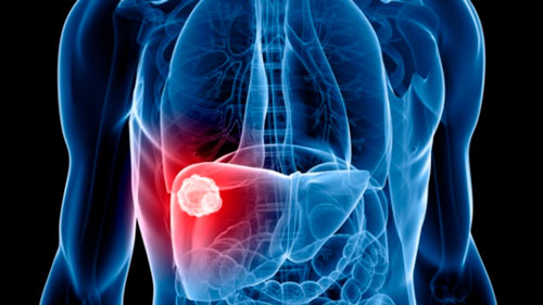 microBIOblog's tweet photo. Casos de hepatitis severa de origen desconocido en menores de 6 años.
Lo que sabemos hasta ahora, te lo cuento en microBIO https://t.co/kuUPyI3sHN https://t.co/g7NBhdTji0