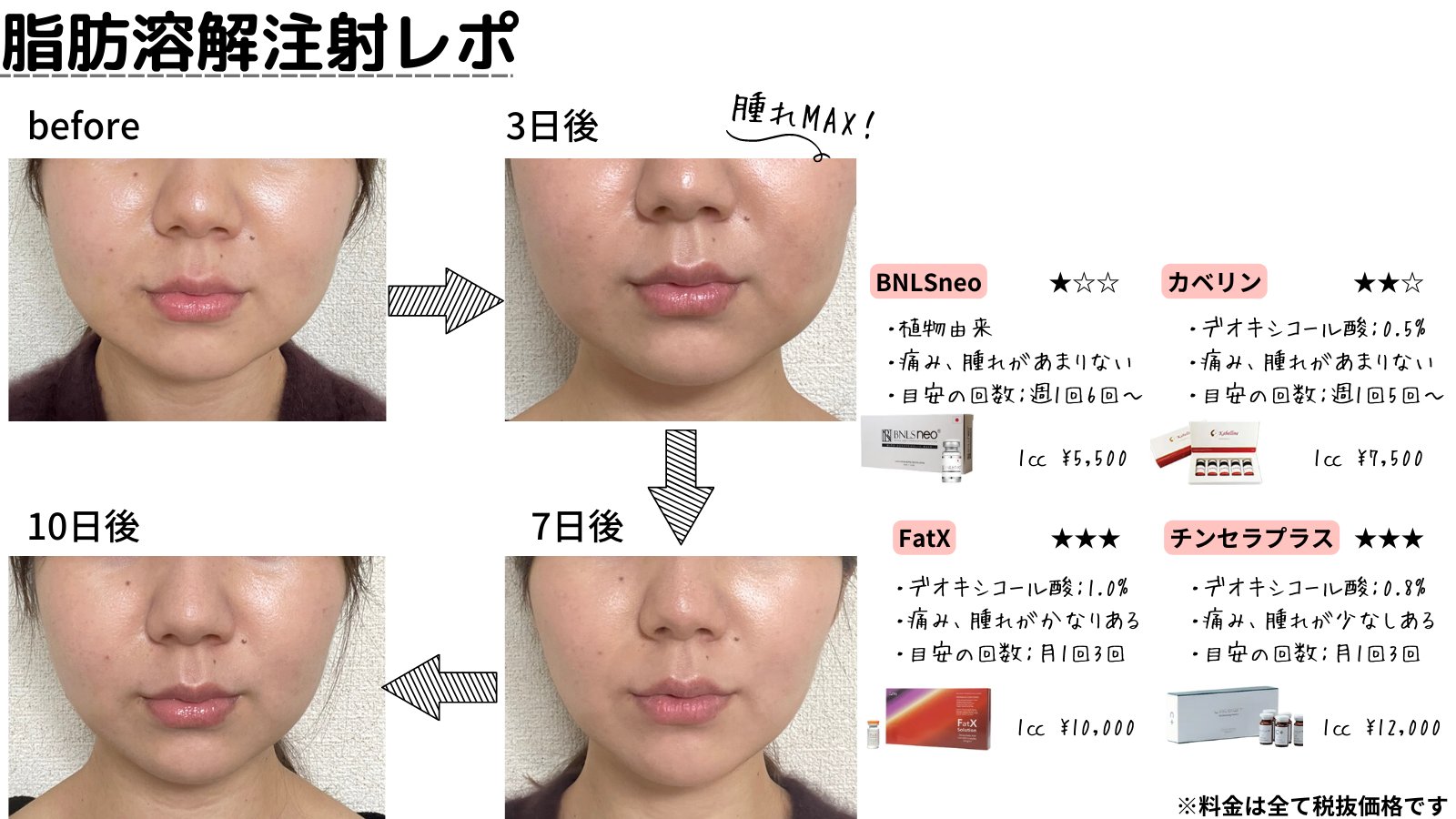 フィラークリニック 公式 脂肪溶解注射 レポ 脂肪溶解注射は脂肪細胞自体を分解 溶解する事で部分痩せ効果が実感できる施術です 溶解した脂肪は 汗や尿として自然と体外に排出されます T Co Ijmuv8dncs T Co 5gn1bv3pqy Twitter