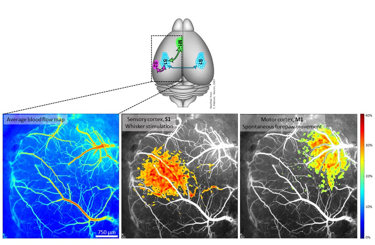 ChrStaehr's tweet photo. Balance between neuronal activity and local blood supply is facilitated by #neurovascular coupling🧠. Here, I’ve stimulated the whiskers of an awake 🐭resulting in⬆️blood flow in the sensory cortex. Forepaw movement⬆️blood flow in motor cortex.
#LaserSpeckleImaging #MatchkovLab https://t.co/qiQsBs28N0