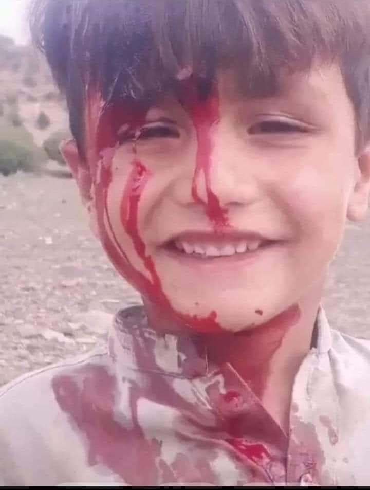 QayyumAfghan9's tweet photo. Hello Pakistan our mothers sisters and brothers also human being
#Khostattack #StopPashtunGenocide https://t.co/wsBenIy8o0