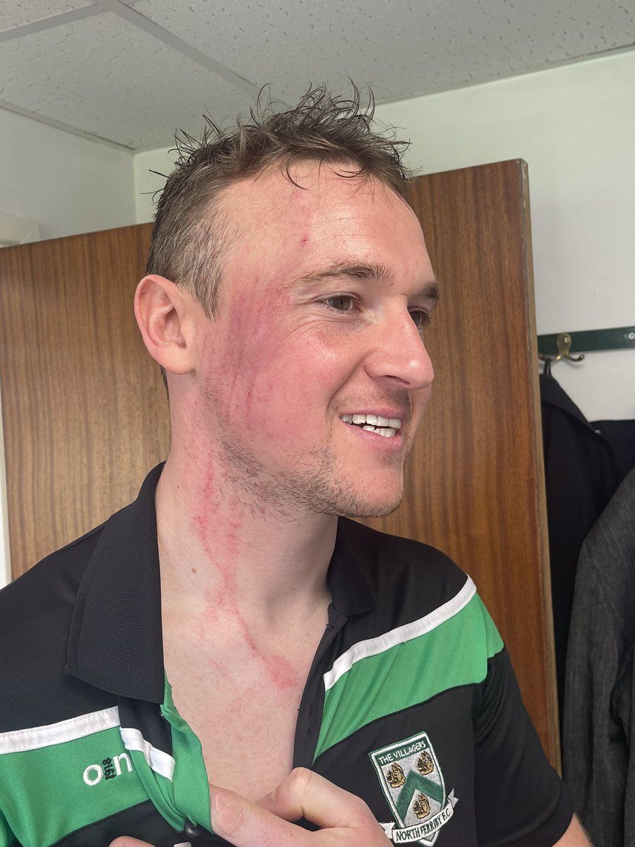 north_ferribyfc's tweet photo. “Not a red card” https://t.co/vZWtmxJeT0