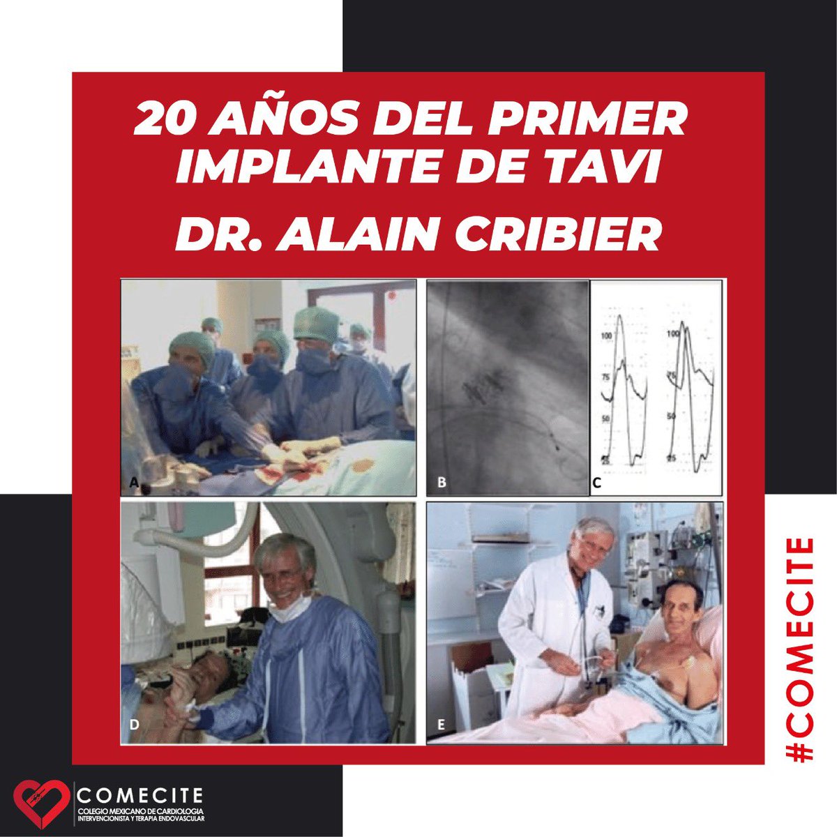 comecite's tweet photo. En COMECITE conmemoramos 20 años de la primer TAVI por el Dr. Alain Cribier, estamos muy orgullosos de poner en practica sus enseñanzas en México cada día.
#COMECITE #TAVI #INTERVENCIONISMO https://t.co/vuT9QQkecv