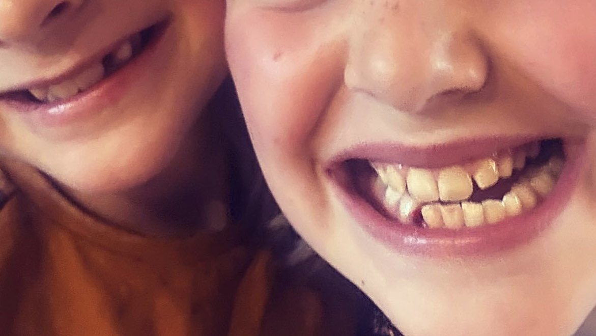 nicksmitsocial's tweet photo. Maffe kinderen... Zoon 7yo trekt even zijn melktand eruit... Dochter 9yo geeft aan dat ze nu gelijk staan met 8-8 wat betreft tanden wisselen en dat kan natuurlijk niet... 5 min later trekt dochter ook een melktand eruit.. 8-9 😂😂🙈 https://t.co/Yy1QvAtrBT