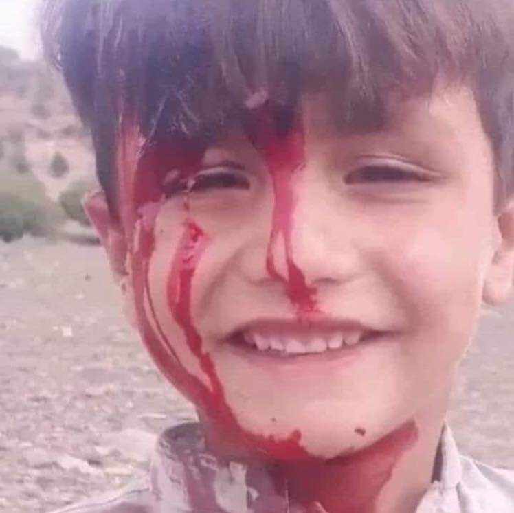Saif_pakhtoon's tweet photo. #StronglyCondemned
Pakistani forces' attacks in Khost & Kunar in which many civilians were killed & wounded.
It is violation of Human Rights and is a Crime Against Humanity.
@HM_Kakar @YousafAnwar1
@TOLOnews @pajhwok @CrystalBayat37 @fannydellinger @candybowman @LaibaYousafzai2 https://t.co/zUVcEYGhPN