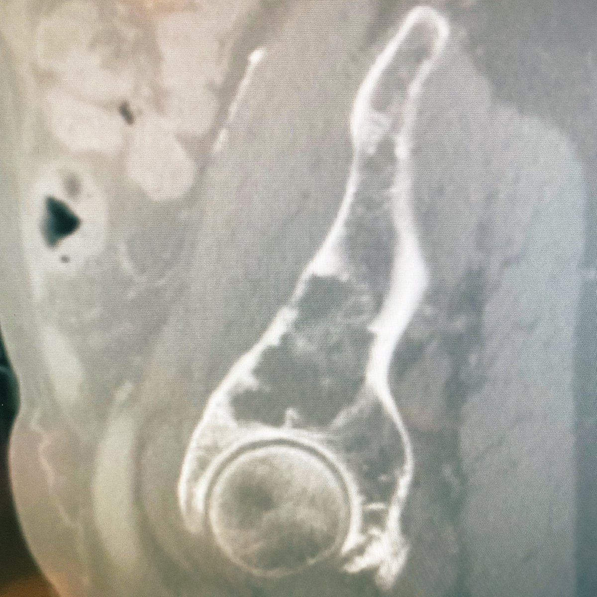 UC San Diego Interventional Radiology tweet media