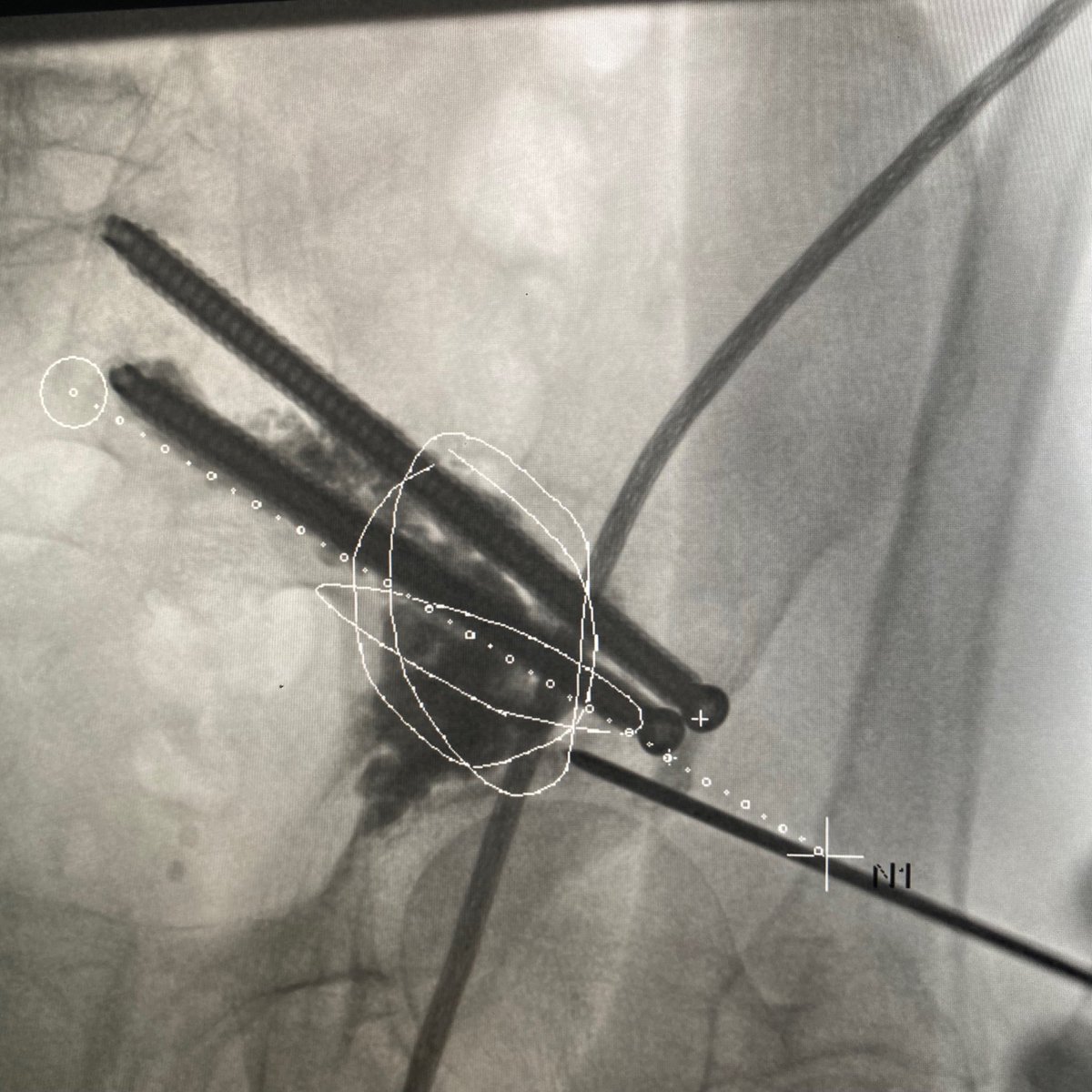UC San Diego Interventional Radiology tweet media