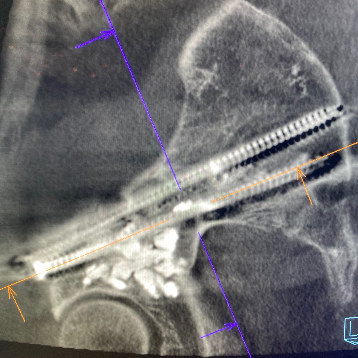 UC San Diego Interventional Radiology tweet media
