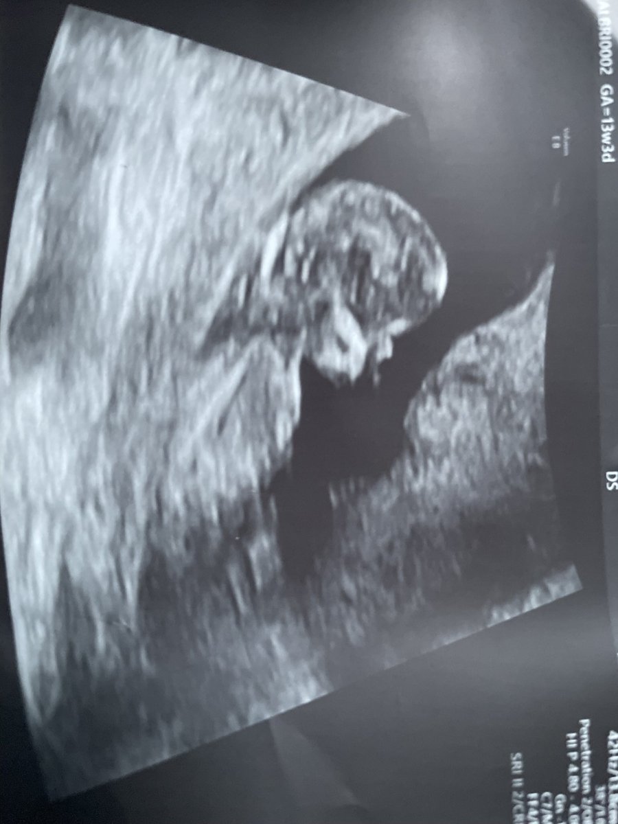 ___darb's tweet image. BITCH IM A FATHER