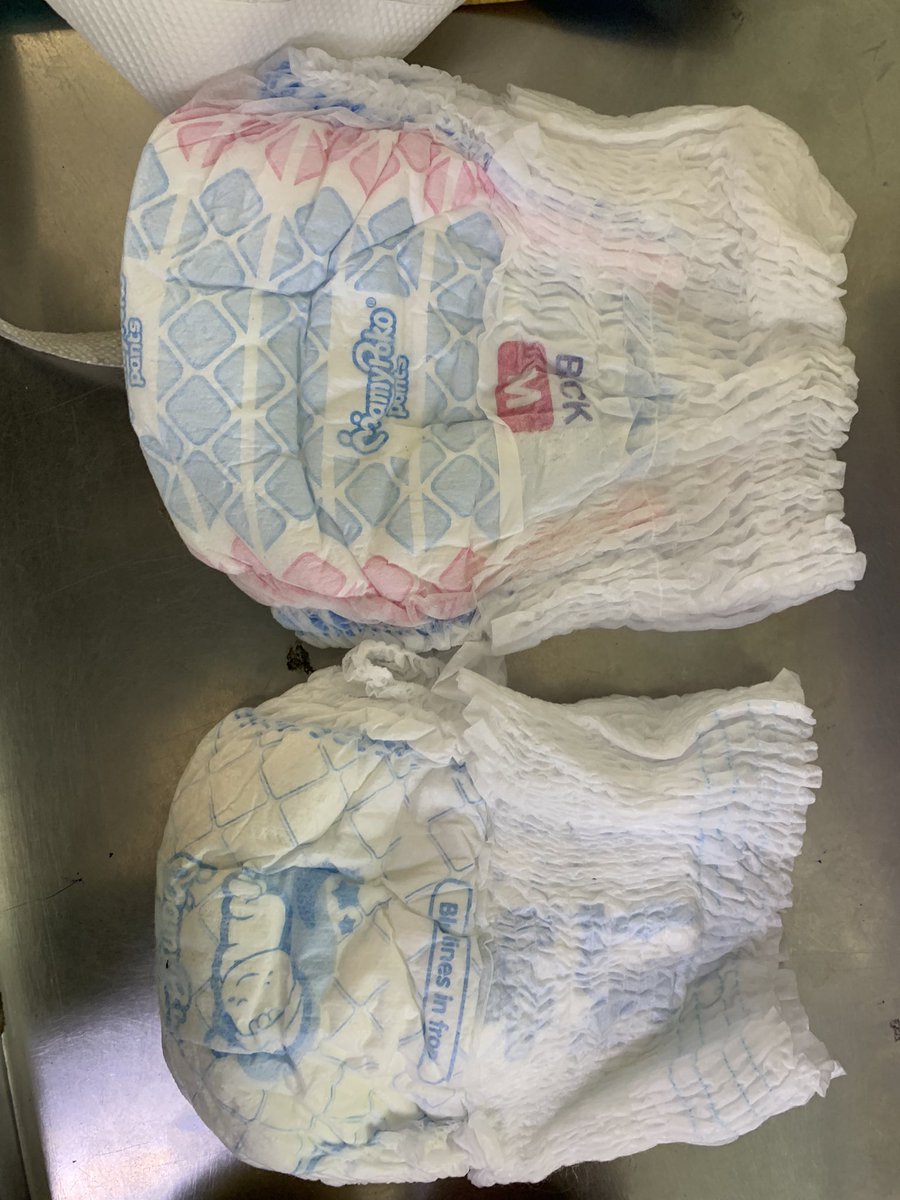 tusharsamar's tweet photo. @RelianceFreshIN ds is very sad that items purchased 4m reliance fresh is defective and managers r not helping in exchanging. I purchased baby diapers of M size but actual size  differs. They say item is not there since 20 days to exchange. Kindly help.@reliancegroup @reliancejio https://t.co/P9y42xUa10