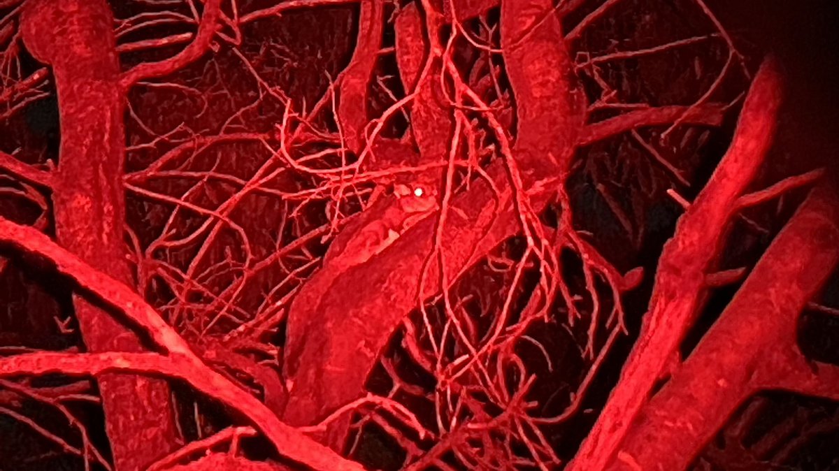 Harry Saddler tweet media