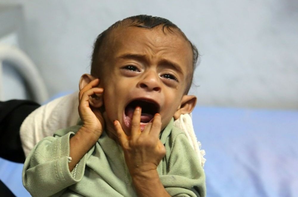 BdGEORGES's tweet photo. Face au malheur et à la souffrance, selon qu'un enfant sera européen, arabe ou africain, blanc ou noir, chrétien ou musulman, ... pour beaucoup, il vaudra un peu plus ou un peu moins qu'un être humain ! #Ukraine #Syrie #Afghanistan #Yémen #SudSoudan #Rohingyas #Venezuela ... https://t.co/rArtUmd6h2