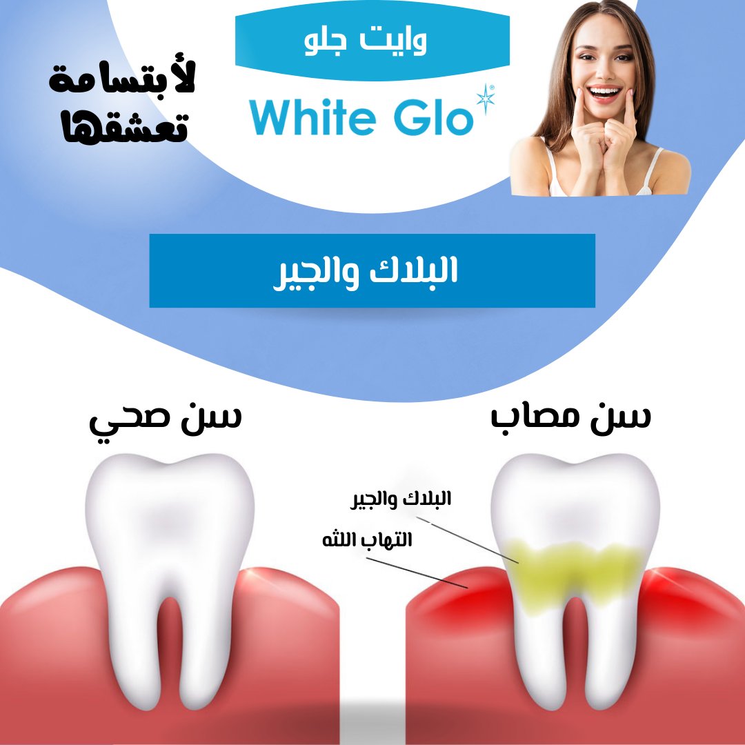 whitegloksa's tweet photo. يتشكل #البلاك و #الجير على #الأسنان من مزيج من اللعاب والأطعمة والسوائل وهي عبارة عن غشاء أصفر لزج وشفاف يتشكل باستمرار على #أسنانك وعلى طول خط #اللثة
غالبًا يكون هذا سببًا للعديد من مشاكل الأسنان مثل #التسوس و #التهاب_اللثة الذي يسبب #رائحة_الفم_الكريهة
https://t.co/JLGr4CBjet https://t.co/CeUwZQ1SPz