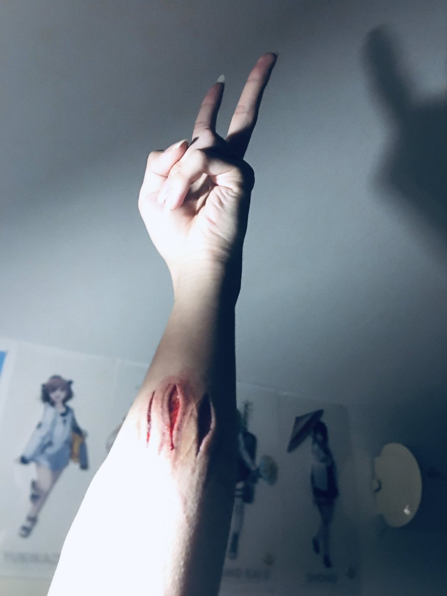 amu1353's tweet photo. 開くのマスターしたのかも
めちゃくちゃ綺麗に開いたぜ、
けど今日は少し多めに血が出てほしかったかな
#リスカ #アムカ #自傷行為 https://t.co/YQ1pCE71zr
