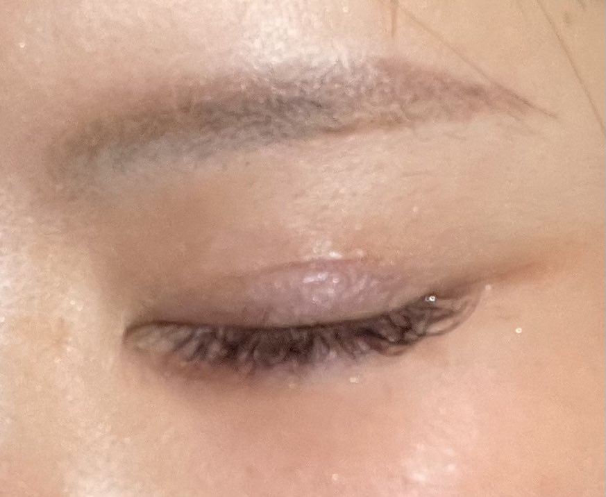 こないだ目の執刀医に、傷痕全く無くて綺麗だからHPに症例載せていい?と言われた。なんとなく断ったけど、自慢したくなるような作品に仕上げて貰えたんなら幸運だな。失敗も計り知れないが諦めず挑戦し続けたら良いこともある。 https://t.co/GupwzJDveo