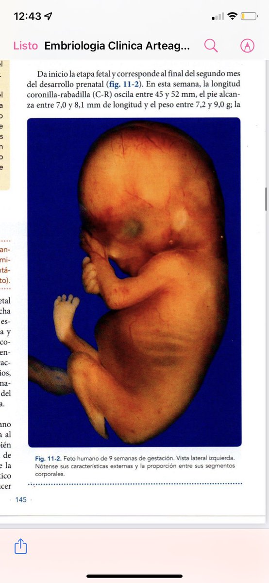 ccanalesss's tweet image. Quien diga que los embriones y fetos no tienen forma humana o son cúmulos de células… claramente nunca ha abierto un libro de embriología