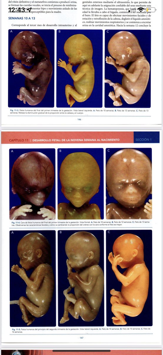 ccanalesss's tweet image. Quien diga que los embriones y fetos no tienen forma humana o son cúmulos de células… claramente nunca ha abierto un libro de embriología