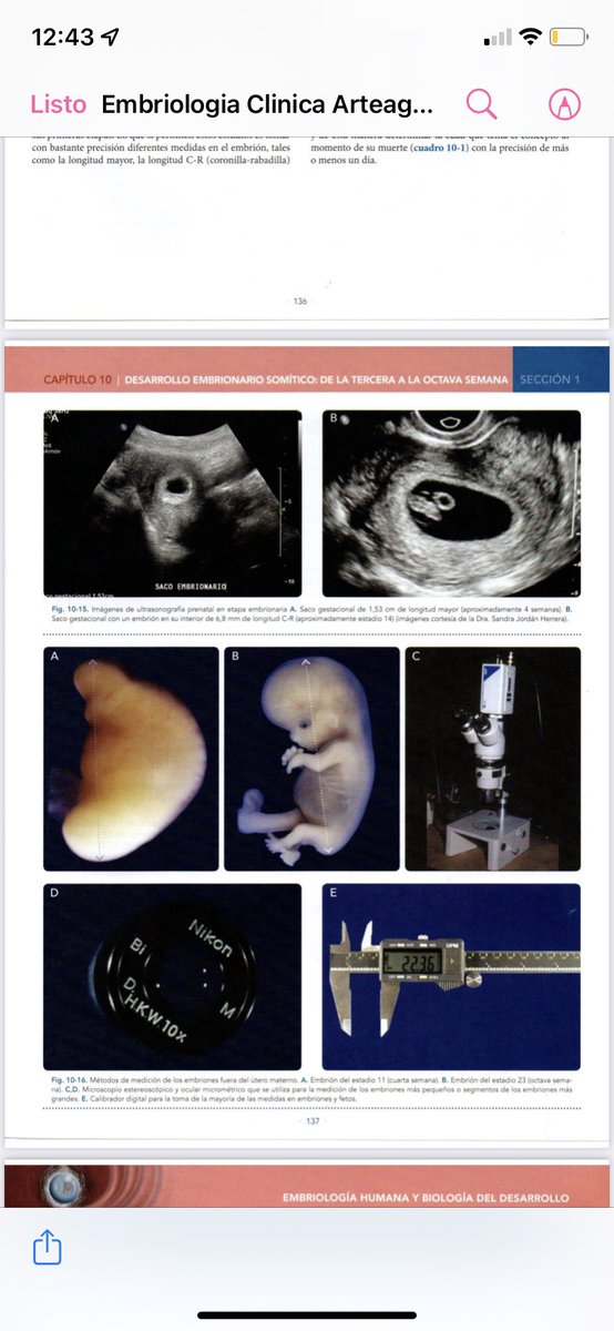 ccanalesss's tweet image. Quien diga que los embriones y fetos no tienen forma humana o son cúmulos de células… claramente nunca ha abierto un libro de embriología