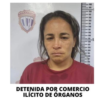 InformadorVeraz's tweet photo. Detenida en Portuguesa LA REVOLUCIONARIA, CHAVISTA y MILITANTE DEL PSUV marielys del carmen yedra, con CASA REGALADA POR LA MISION VIVIENDA (quinta oleada) por publicaciones en la que ofrecia ilegalmente a través de Marketplace un riñón por la cantidad de 20.000 dólares https://t.co/gB0Kd2WxMa