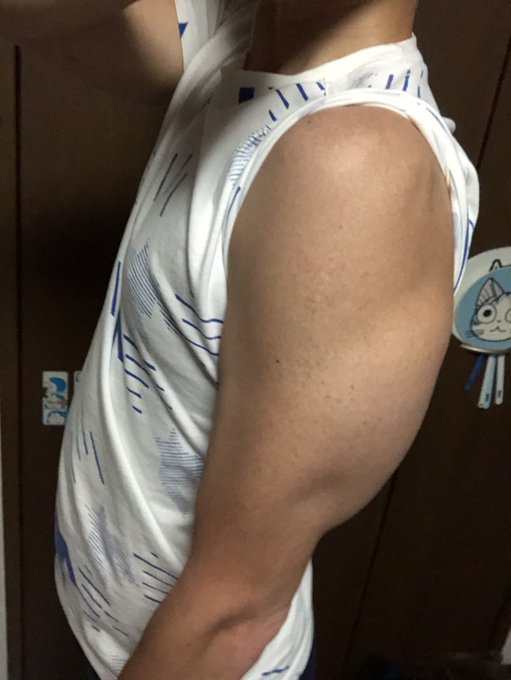 素人質問で申し訳ないのですけど、二の腕の後ろ側?にボコってなってるのは上腕三頭筋ですか? 