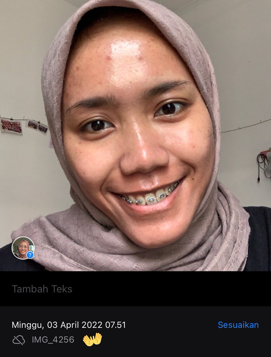 nisskyx's tweet photo. —best moisturizer buat memperkuat skin barrier💯

Simpan twit ini karena pasti kamu butuhin suatu saat nanti👀😆

-
Rate: ⭐️⭐️⭐️⭐️⭐️

Ini berdasarkan pengalaman pribadi yaa guys, alias honest review👌🏼 #RacunNis https://t.co/LulOEnQPML