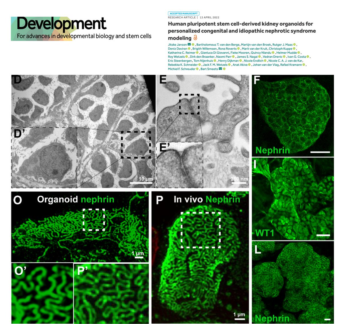EndlichNicole's tweet image. @VDrenic @NIPOKA_Podocyte  &amp;amp; I @UMGreifswald  are happy to be part of an amazing paper @Dev_journal using 3D-SIM to show podocyte foot processes with the slit membrane in between, developed from organoids. Many thanks to Jitzke Jansen &amp;amp; @BartSmeets11 for an excellent cooperation!