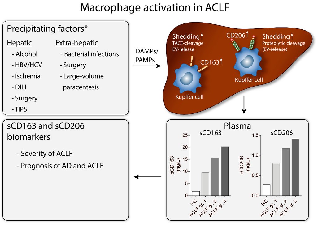 Cells_MDPI's tweet photo. "#Macrophage Activation Markers, #CD163 and #CD206, in Acute-on-Chronic #Liver Failure" from Nielsen et al.
#cellsmdpi #cellbiology #scavengerreceptor

Full text: https://t.co/fJUoxKD9z1 https://t.co/mSH6tWZNYD