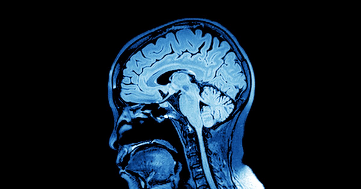 Blood flow to your brain naturally slows down as you age, and it affects your frontal cortex first -- that’s where you store words. Regular exercise can get your heart pumping, and bonus blood can keep your mind humming. wb.md/3KGJhNn