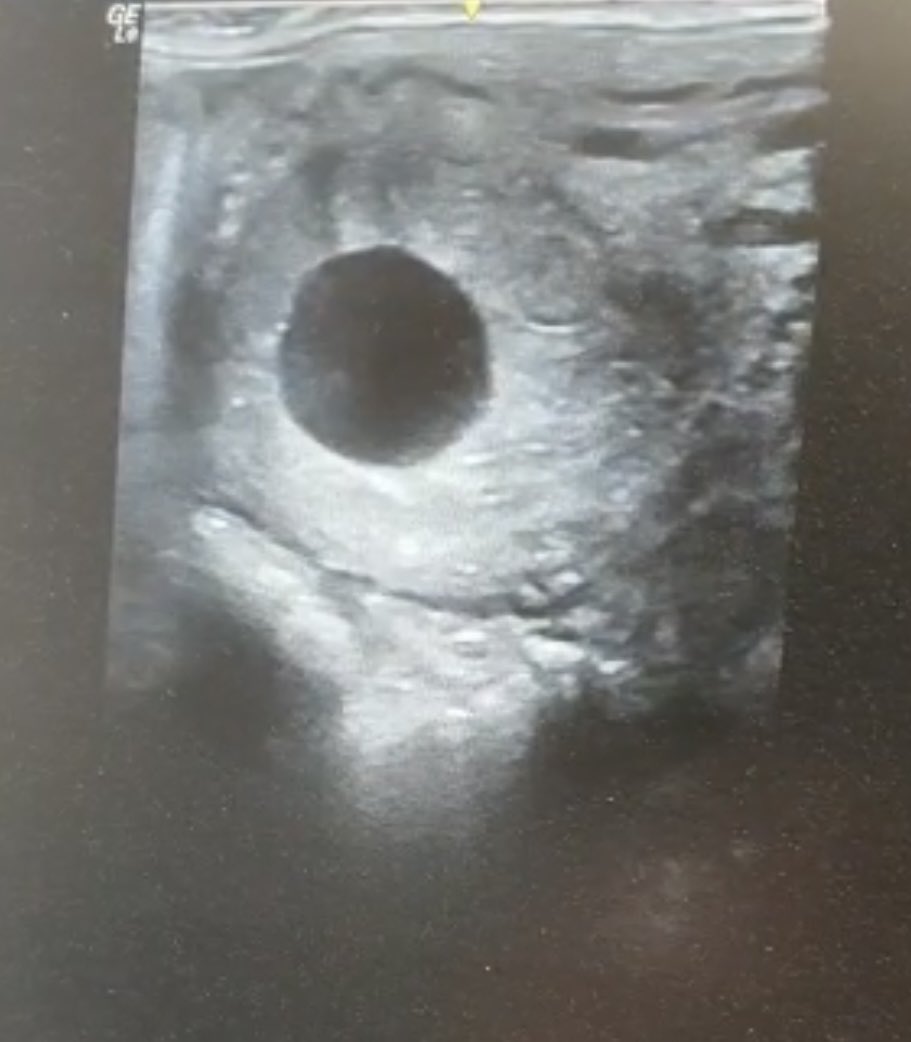 Neil Simpson (@neil_simpson5) on Twitter photo Mare scanned in foal today to the excellent Cable Bay. Good job Highclere Stud @JakeJWarren and <a href="/MildmayStud/">Oliver Nash</a> #cablebay Mare scanned in foal today to the excellent Cable Bay. Good job Highclere Stud @JakeJWarren and <a href="/MildmayStud/">Oliver Nash</a> #cablebay
