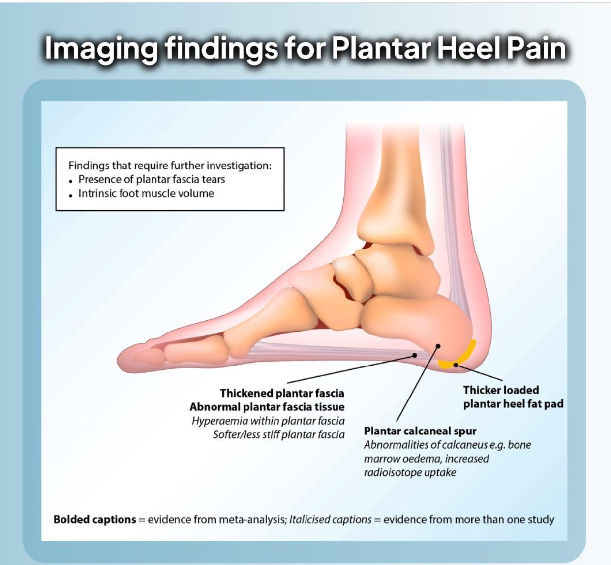 Expectations During and After Heel Spur Surgery | NYC Podiatrist