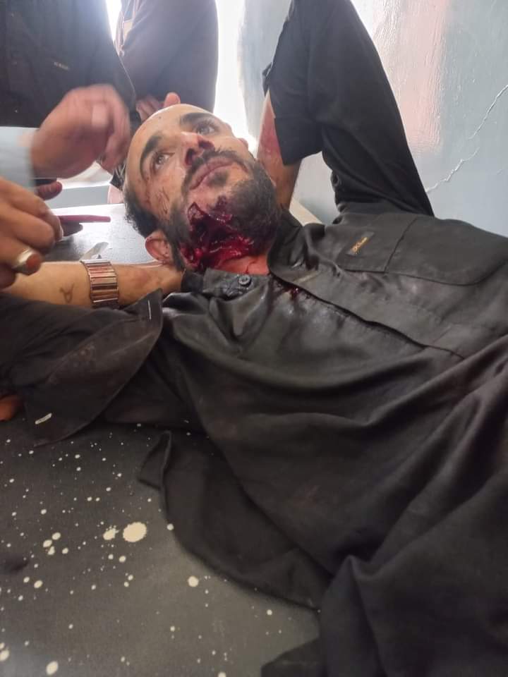 iFahadZeb's tweet photo. If you are neutral on situations of injustice, you have chosen the side of the oppressor. 
#ChaghiBleeds #BalochLivesMatter #Pakistan https://t.co/MFoCy4VGaK