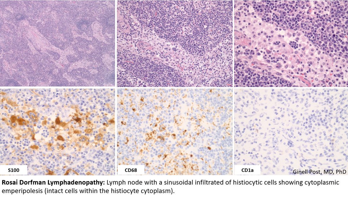 UAMS Hemepath tweet media