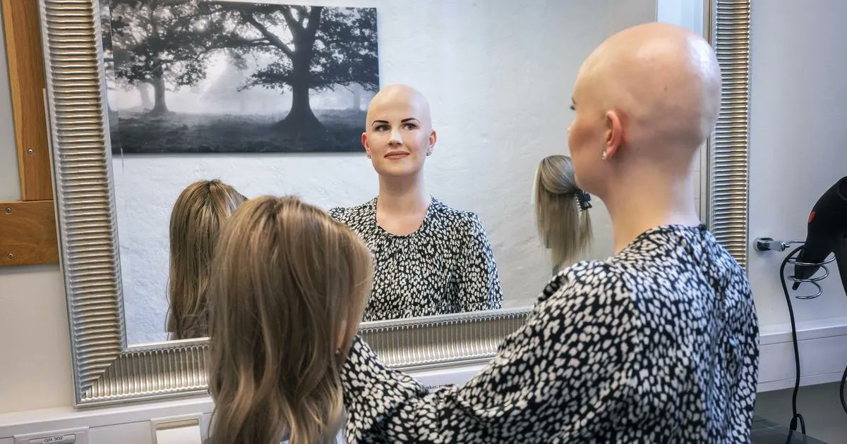 hdhbg's tweet photo. Renée, 28, om att leva utan eget hår: ”Kan vara festredo på fem minuter” https://t.co/2rObw9WZ17 https://t.co/7XMraihZiG