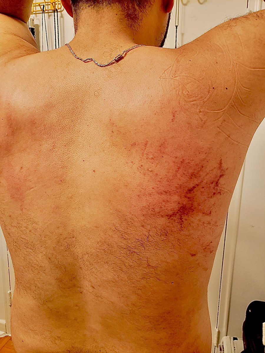 Service_Danimal's tweet photo. Got a New haircut! What do you think? 

#newhaircut #freshcut #beautymarks #earnyourstripes #kink #hairysub https://t.co/pfzfnfFEAF