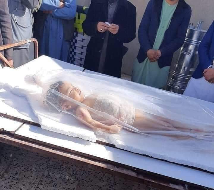 Masoud22857742's tweet photo. @BBCYaldaHakim The smallest victim of today's Kabul terrorist attacks. Our nation is thirsty for peace. https://t.co/WkDDeDNIB9