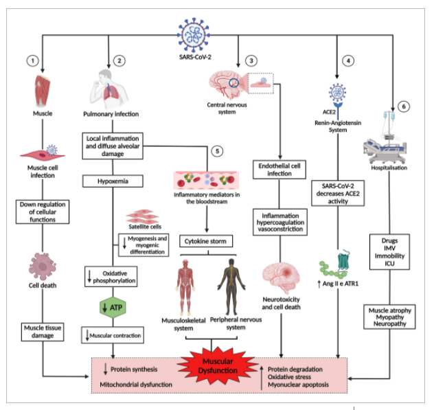 HarrySpoelstra's tweet photo. Muscle dysfunction,characterized by decreased synthesis and increased protein degradation, increased oxidative stress,myonuclear apoptosis, and mitochondrial dysfunction➡️generalized fatigue + muscle weakness #LongCovid
➡️There is more #Multisystemdisease https://t.co/PAYEY3VPO4 https://t.co/2248xXUqXA