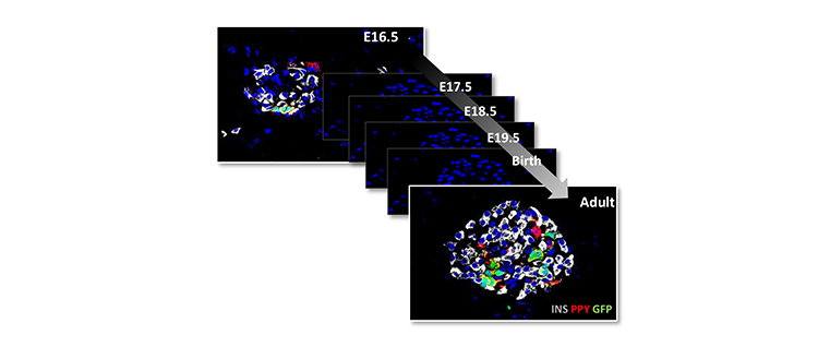 UNIGEnews's tweet photo. Une équipe de l’UNIGE démontre que les #cellules souches endocrines sont absentes dans le #pancréas après la naissance. Elle précise également l’identité #génétique des cellules #endocrines.
https://t.co/0kOomB6TE7 https://t.co/ea8bYd3B7u