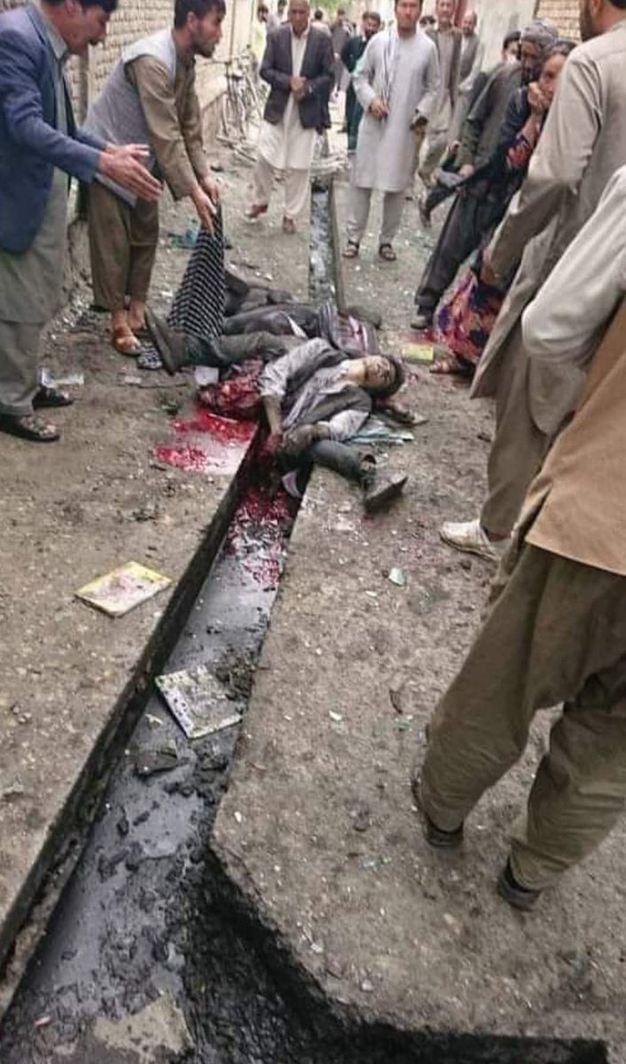 MunazaShaheed's tweet photo. Yes, ofcourse it is graphic ⚠️!!

Let the world watch the day to day Afghan’s story.

@hrw @UNHumanRights @amnesty 

#KabulBlasts https://t.co/8PNk9GQSKo