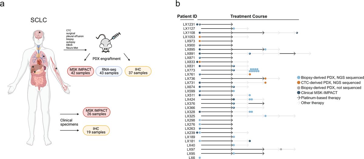 NatureComms's tweet photo. @CaeserRebecca @triparnasen and colleagues create patient derived #xenograft models from 33 small-cell #LungCancer patients and show through #multiomics that they retain the primary features of the original patients

#CancerResearch @NatResCancer 

https://t.co/8DVcXWjlfU https://t.co/CZzC6YOWsS