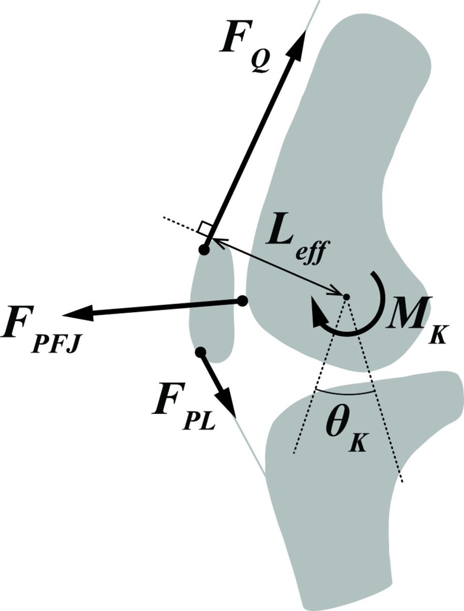 BJSM_BMJ's tweet photo. May the force be with you ✋🚀

The #EditorsChoice article from this month's issue 📄

Understanding how patellofemoral joint reaction force compares across different activities and physical interventions

➡️ https://t.co/T8SpBeZLw2 https://t.co/21PtRb03YM