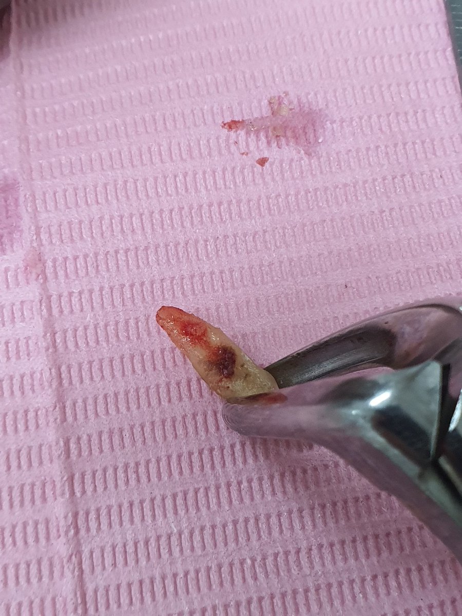 Indigo_Bed's tweet photo. GUYS I PERFORMED MY FIRST ORAL SURGERY https://t.co/Wdhzi10hc2