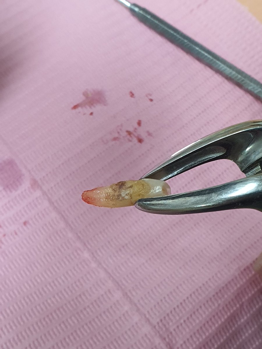 Indigo_Bed's tweet photo. GUYS I PERFORMED MY FIRST ORAL SURGERY https://t.co/Wdhzi10hc2