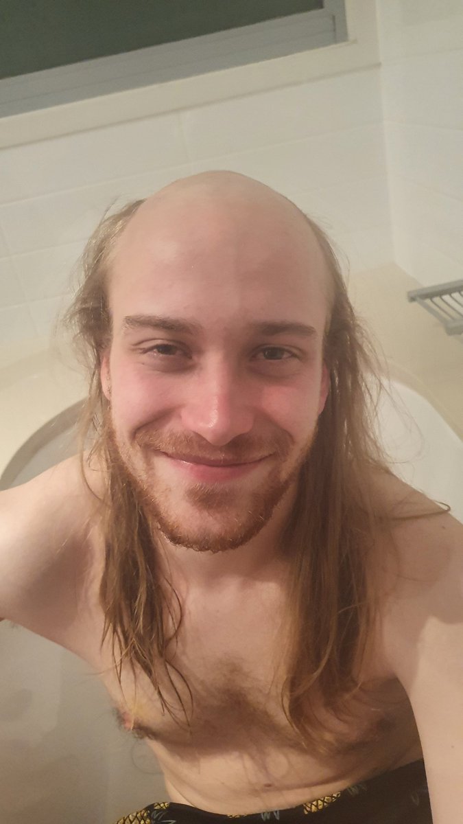 Tell me the difference between these two photos