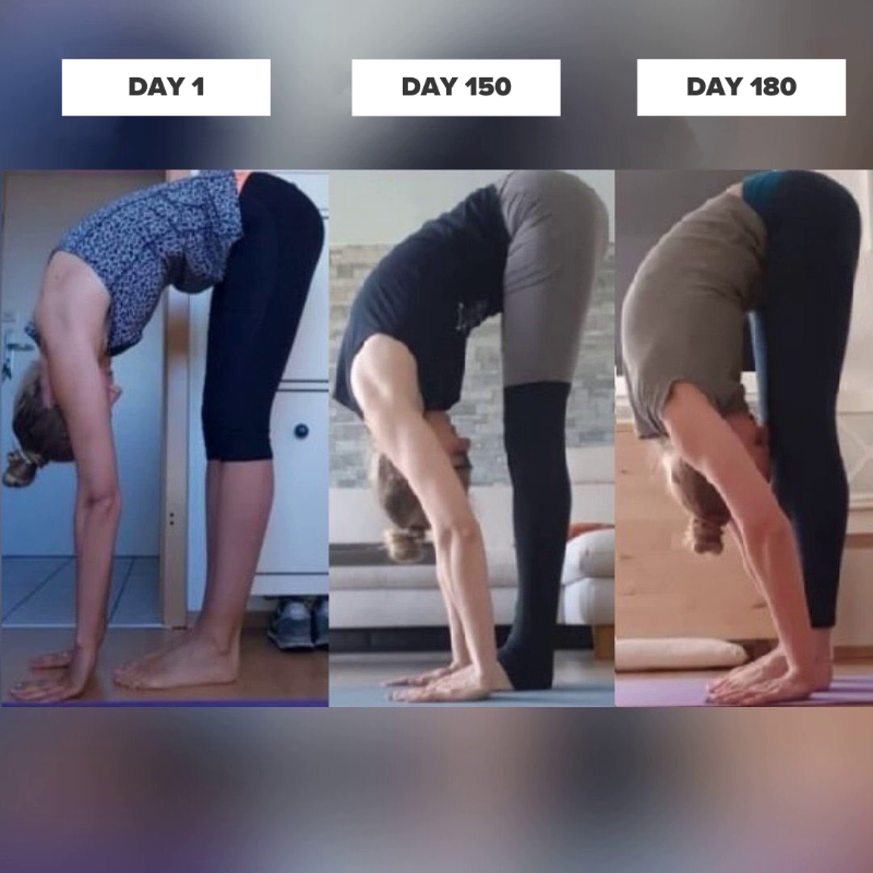 stretchitapp's tweet photo. "This app didn't just make me flexible but it also helped me build the strength those scarred muscles needed. I have a much better and stronger back (and my scoliosis hurts less). And most importantly I understand what to stretch, how, and why. Thank you StretchIt!"
