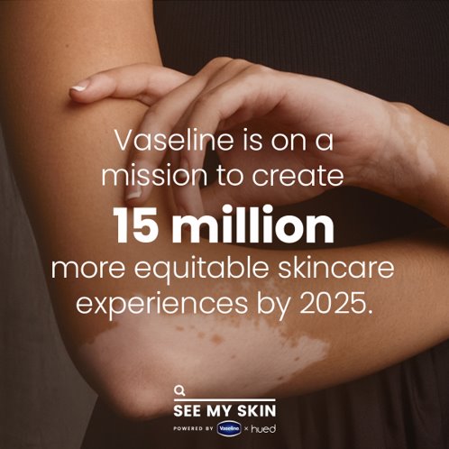 Introducing See My Skin: the only database made for searching conditions on skin of color &amp; connecting people to dermatologists who understand melanin-rich skin, developed in partnership with <a href="/WeAreHUED/">HUED</a> and <a href="/VisualDx/">VisualDx</a>. 

Visit SeeMySkin.com to learn more.