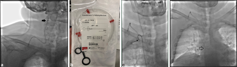 SemInterventRad's tweet photo. Review Article:
Understanding the Basics of Commonly Used Wires in Interventional #radiology 
https://t.co/XXnLHVM6Qu
#irad #guidewires https://t.co/oCDSLsn8GQ