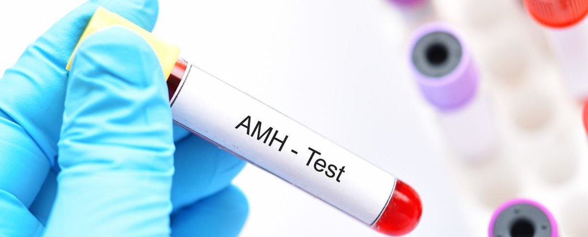An article from our April issue! 
Anti-Müllerian hormone as a predictor of pregnancy in women under 35 years with unexplained infertility undergoing ICSI: a retrospective study 
 
pubmed.ncbi.nlm.nih.gov/33904685/ 
 
#minervaginecologica #infertility #predictor #AMH #hormones