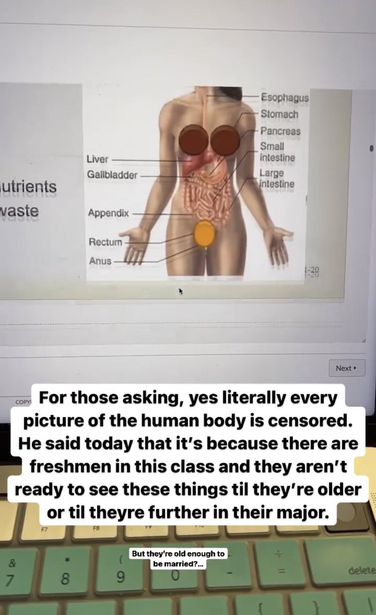 _Kristine_A's tweet photo. In todays edition of ~wtf @byuidaho~ college level Anatomy class puts censor bubbles because p*rn I guess (organs, the nervous system, and vein diagrams). I don’t censor these for my kids of any age, I can’t you guys https://t.co/cnwMuP4lyk