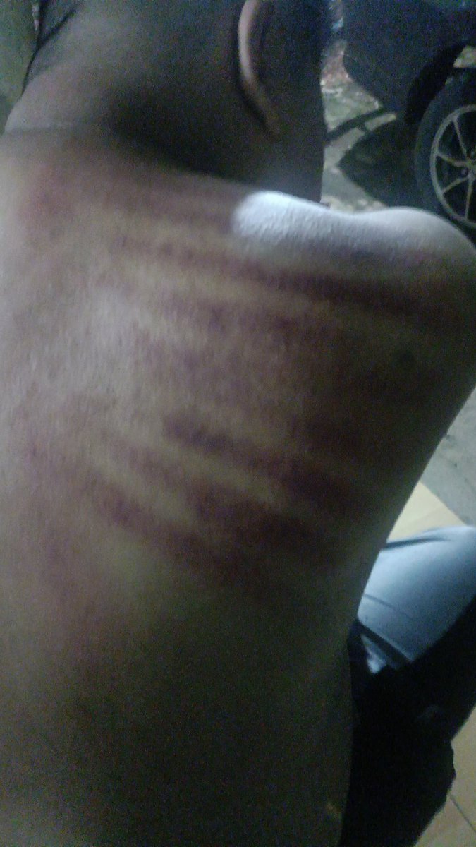 Masuk angin kerokan nyuk mas mbak