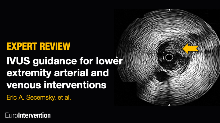 Davide Capodanno (@dfcapodanno) on Twitter photo This expert review details the utility of intravascular ultrasound (IVUS) for the management of peripheral artery and venous disease, and provides contemporary examples and representative imaging to serve as a resource for the practising clinician. eurointervention.pcronline.com/article/intrav… This expert review details the utility of intravascular ultrasound (IVUS) for the management of peripheral artery and venous disease, and provides contemporary examples and representative imaging to serve as a resource for the practising clinician. eurointervention.pcronline.com/article/intrav…