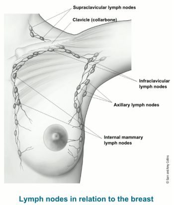 DrTedJames's tweet image. I'm pleased to announce that we now have the ability to provide patients delayed sentinel lymph node biopsy when appropriate. This new technique helps to avoid unnecessary axillary surgery and reduces the risk of complications.
#breastcancer #bcsm
#breastsurgery #lymphnodes